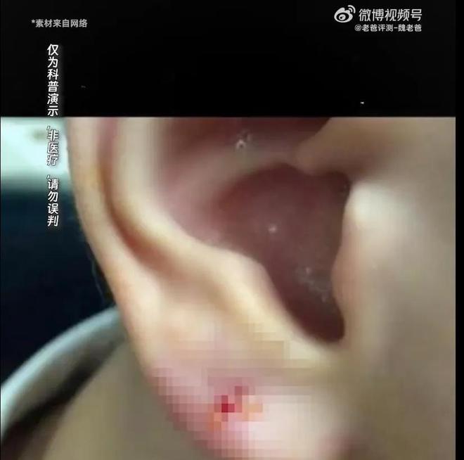 假率超过75%很多人天天用孩子也爱戴开元棋牌网站致癌物超标1179倍造(图16)